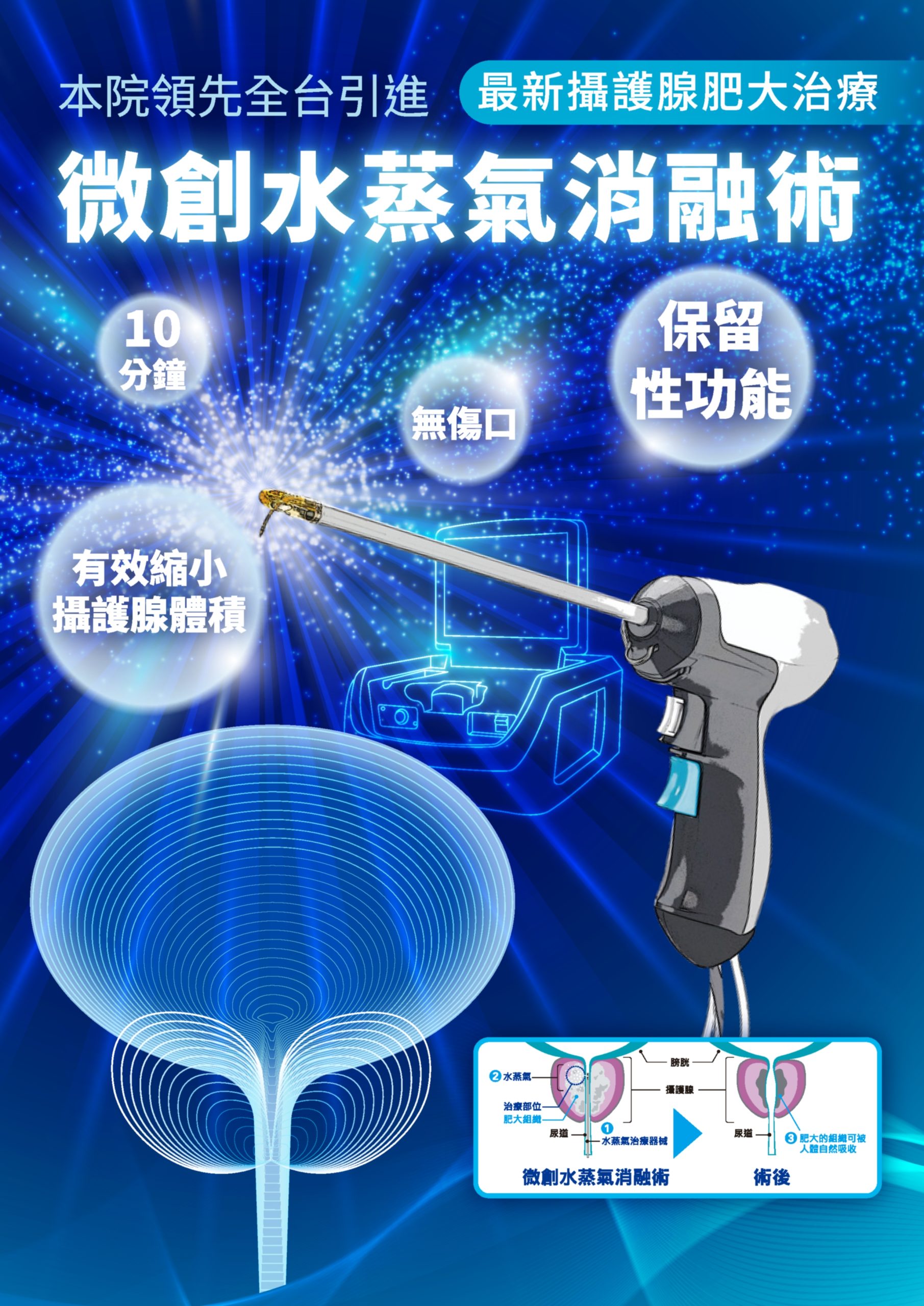 1130827 波士頓 攝護腺海報設計